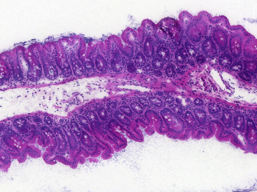 Microscope section showing 622A_cecum through a healthy mouse cecum stained with Haematoxylin-eosin