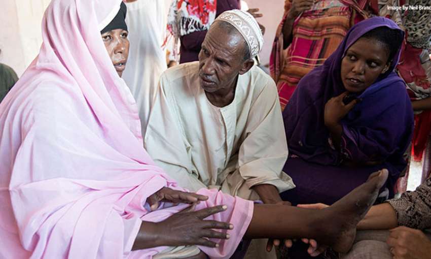 A woman's left foot is checked for mycetoma by DNDi staff in Sudan; her right leg was infected with mycetoma and had to be amputated. Image by Neil Brandvold/DNDi