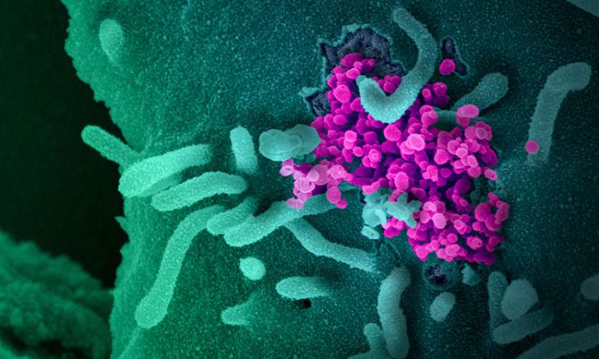 Это изображение сканирующего электронного микроскопа показывает SARS-CoV-2 (круглые пурпурные объекты), выходящие из поверхности клеток, культивируемых в лаборатории.  SARS-CoV-2, также известный как 2019-nCoV, является вирусом, который вызывает COVID-19.  Показанный вирус был выделен от пациента в США. Фото: NIAID-RML