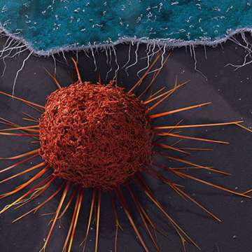 Graphic of a Cervical cancer cell