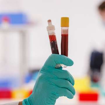 A blood sample for Covid-19 antibody testing at a lab in Hamburg, Germany on April 16, 2020. Image: Morris MacMatzen/Getty Images
