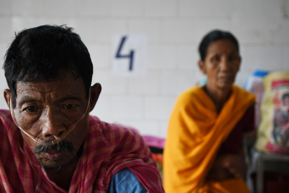 A TB patient uses a nasal cannula during treatment in Tripura, India, on July 7, 2018.