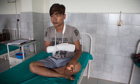 Kamal Malla, one of Dr. Rai's patients, after surgery on his hand. 